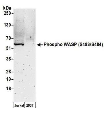 Western Blot: WASP [p Ser483, p Ser484] Antibody [NB100-2307]